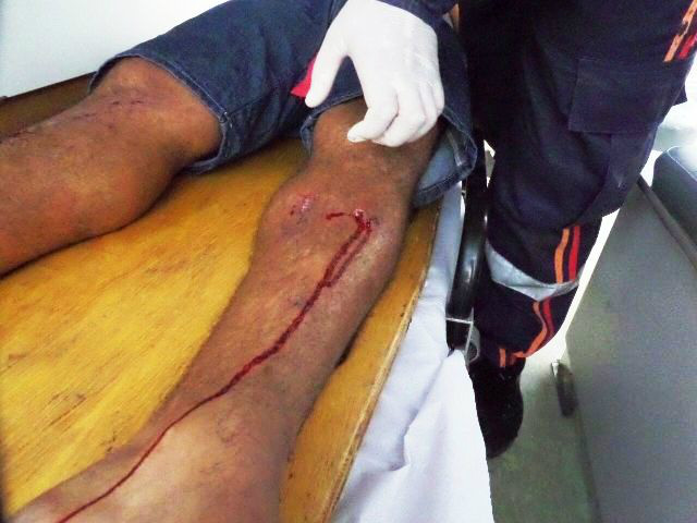 Motociclista em Hornet colide contra pickup e fica ferido Motociclista em Hornet colide contra pickup e fica ferido