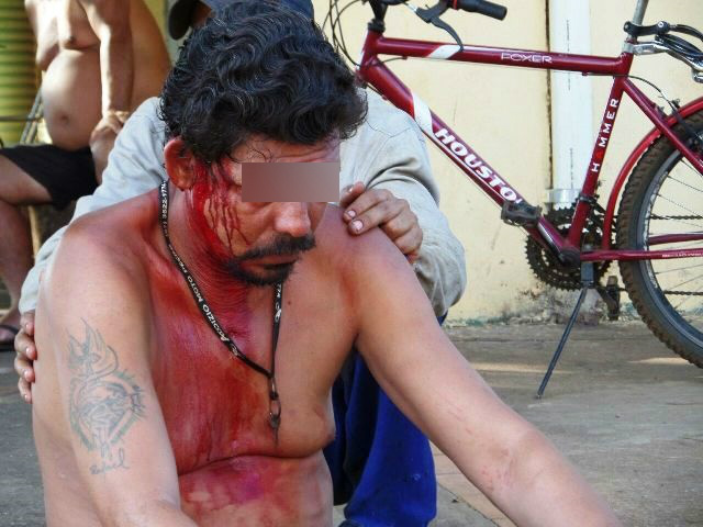 Em briga de bar, homem fica gravemente ferido na cabeça