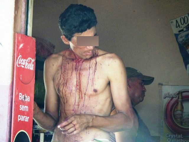 Homem leva paulada na cabeça e duas versões surgem para o motivo da agressão