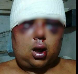 Cabeleireiro é brutalmente espancado na Praça Ramez Tebet Cabeleireiro é brutalmente espancado na Praça Ramez Tebet