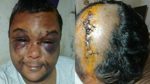 ‘’Saímos para matar veado’’, diziam agressores de homossexual em Três Lagoas