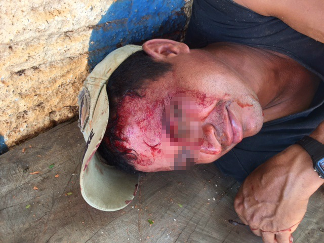 Amigos de “cachaça” brigam e um deles é ferido com bloco na cabeça 