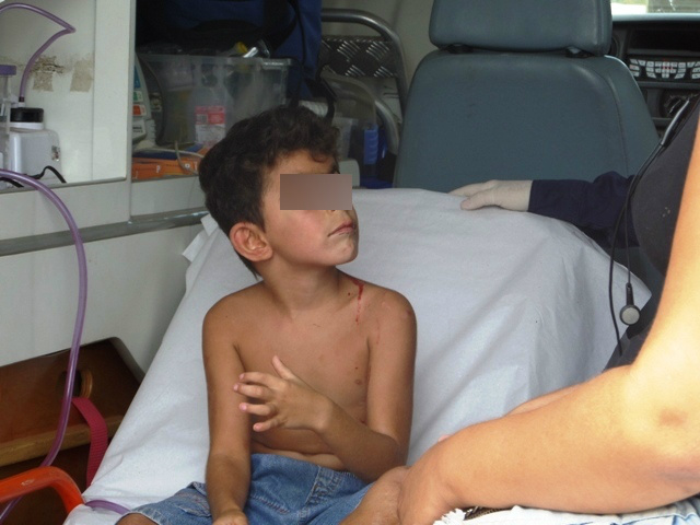 Menino de 06 anos cai de brinquedo e sofre traumatismo craniano