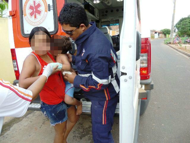  Criança de 03 anos fratura o braço em queda de moto 