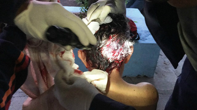 Boxer tem dia de fúria e ataca o próprio dono em residência na Rua 15 de Junho Boxer tem dia de fúria e ataca o próprio dono em residência na Rua 15 de Junho