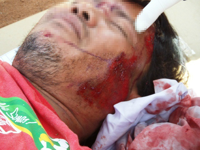 Ciclista é atingido por carro na BR-262 em Três Lagoas Ciclista é atingido por carro na BR-262 em Três Lagoas