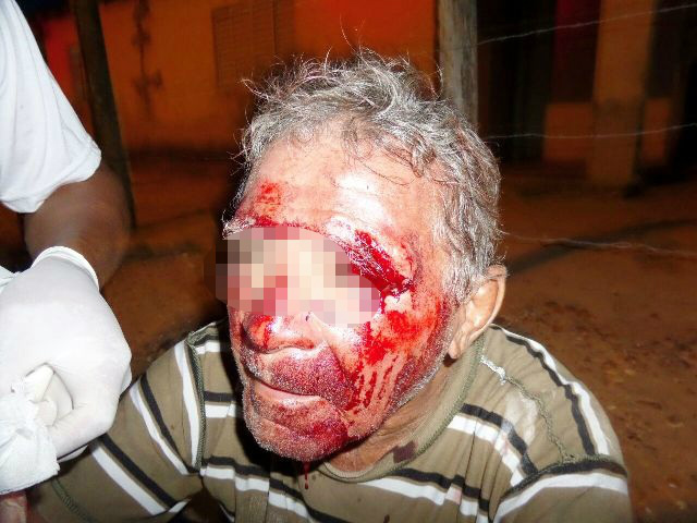 "Cerveja" pode ter provocado acidente com idoso no bairro Ipacaraí