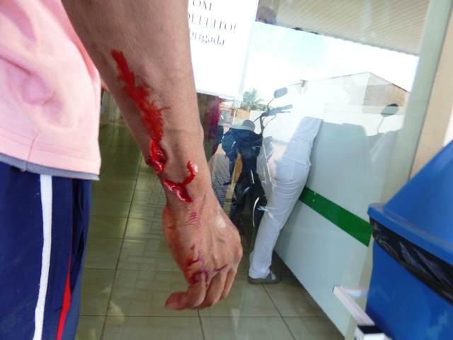Fugitivo da Gameleira tenta realizar furto e fica gravemente ferido