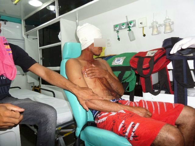 Homem embriagado sofre ferimento na cabeça ao cair dentro da própria casa