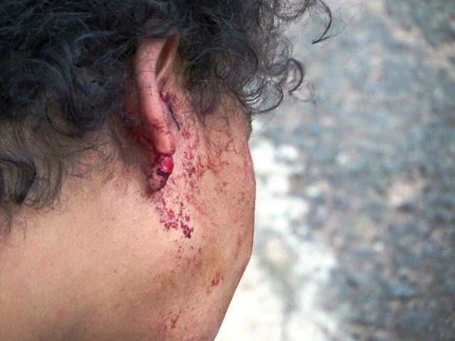 Marido corta a orelha de mulher grávida após briga em via pública 