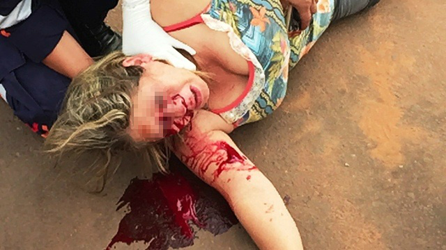 Mulher sofre ferimentos no rosto após acidente no Jardim Flamboyant