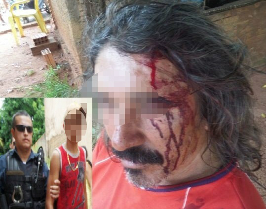 Sem motivos, neto agride o avô com banco de madeira e acaba apreendido pela polícia