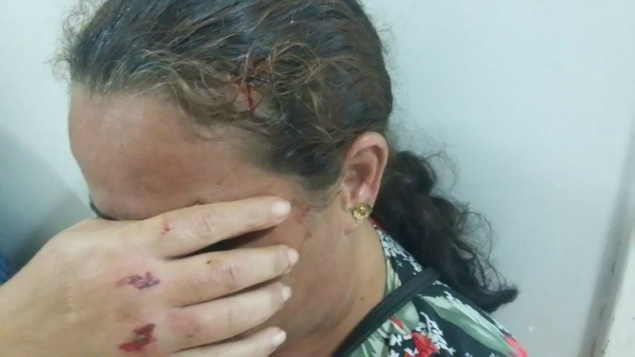 Mulher arremessa panela com óleo quente no marido e é agredida com bloco pela vítima