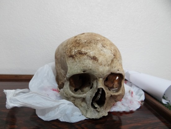 Crânio humano é encontrado em plantação de mandioca e polícia apura o caso Crânio humano é encontrado em plantação de mandioca e polícia apura o caso