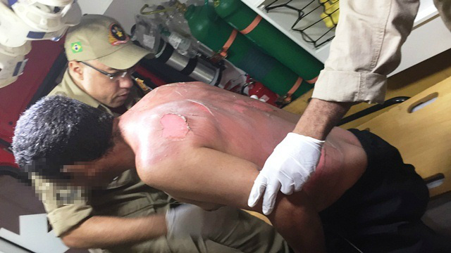 Mulher ateia fogo no marido após discussão em residência de Três Lagoas Mulher ateia fogo no marido após discussão em residência de Três Lagoas