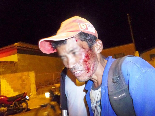 Ciclista cai, fica ferido, nega atendimento do SAMU e volta ao bar para tomar mais cachaça 