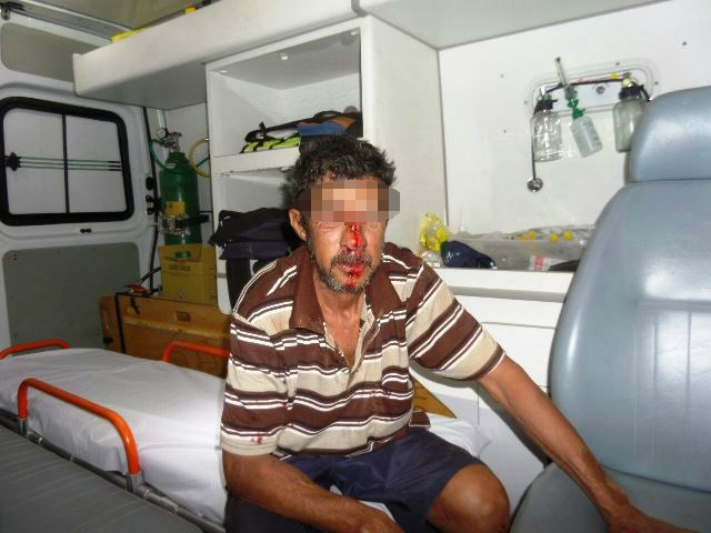  Acidente entre bicicletas deixa um ferido no Jardim Flamboyant 