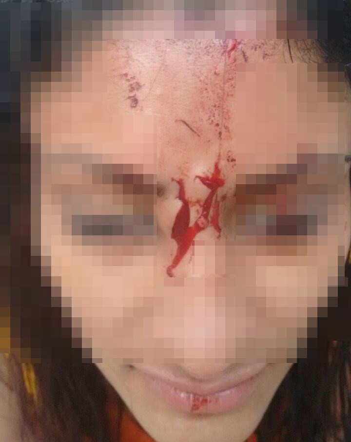 Briga entre sogra e nora termina com a chegada da Polícia Militar 