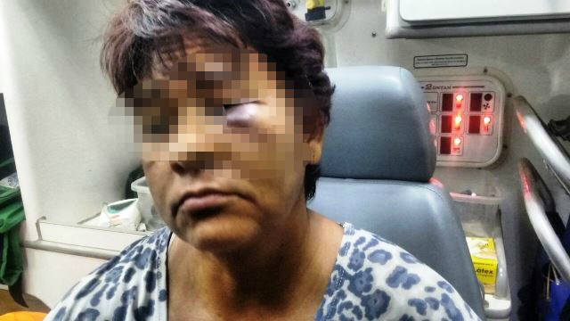Bebedeira termina com agressões contra mulher de 47 anos Bebedeira termina com agressões contra mulher de 47 anos
