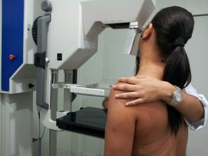 Exame de Mamografia reduzirá em 50% fila de espera em parceria com o hospital