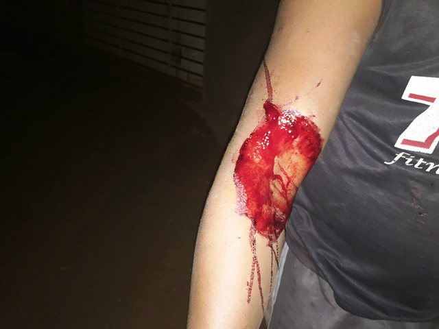 Para se defender de agressões, mulher esfaqueia o marido por duas vezes 