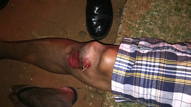 Idoso atropelado sofre fratura no joelho; motorista fugiu do local 