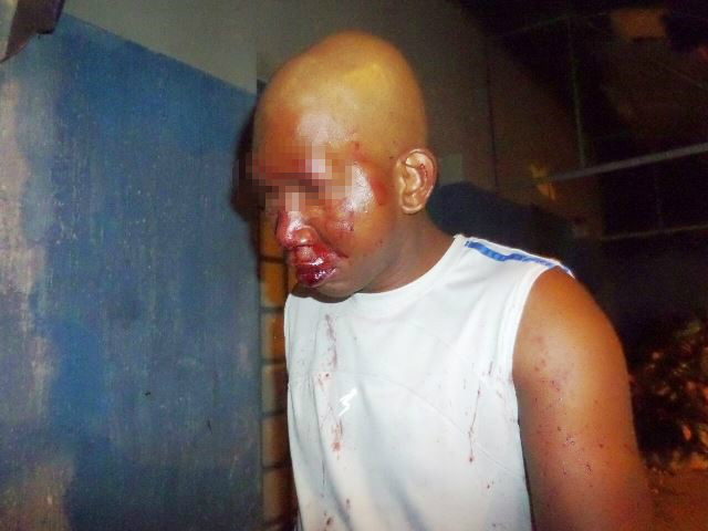 Haitiano é espancado por oito jovens quando passava por avenida de Três Lagoas Haitiano é espancado por oito jovens quando passava por avenida de Três Lagoas