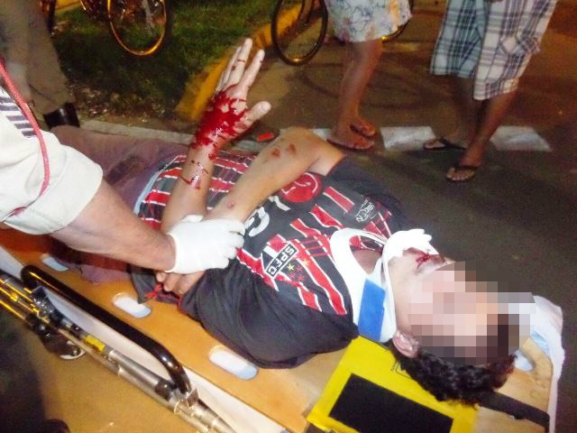 Ciclista bate em obstáculo na ciclovia e na queda, fica ferido no rosto e na mão Ciclista bate em obstáculo na ciclovia e na queda, fica ferido no rosto e na mão