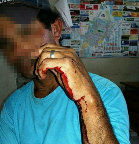 Ao cobrar satisfações do sobrinho sobre furto, Carpinteiro é agredido com barra de ferro