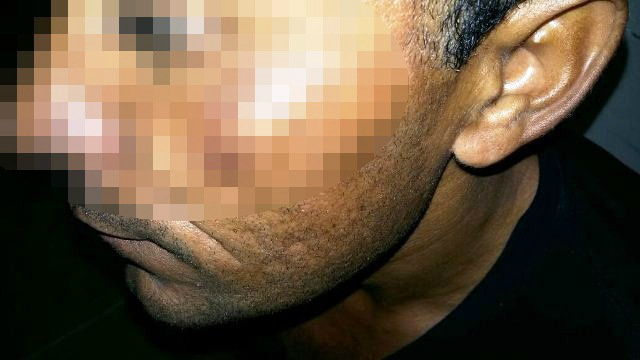 Construtor apanha de mulher com vassoura; polícia é chamada 