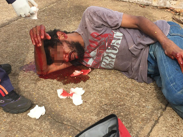 Andarilho é resgatado ao lado do exército com possível fratura no nariz Andarilho é resgatado ao lado do exército com possível fratura no nariz