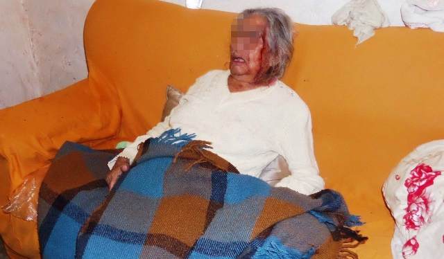Bombeiros socorrem idosa de 82 anos que foi agredida pelo afilhado 