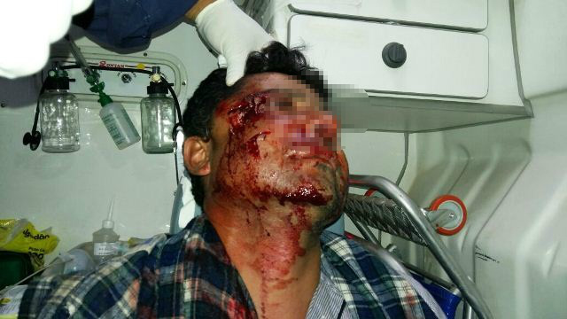 Briga na Praça Ramez Tebet termina com uma pessoa ferida Briga na Praça Ramez Tebet termina com uma pessoa ferida