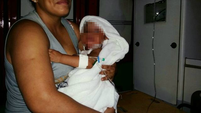 Acidente doméstico causa queimaduras de 2º grau em criança de 1 ano