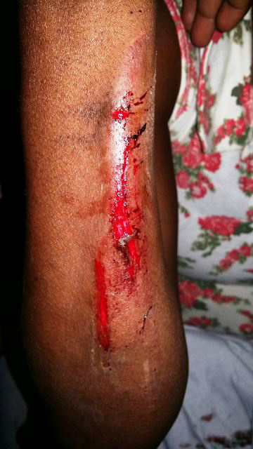 Filho que bateu na mãe ainda agrediu uma criança de 8 anos Filho que bateu na mãe ainda agrediu uma criança de 8 anos