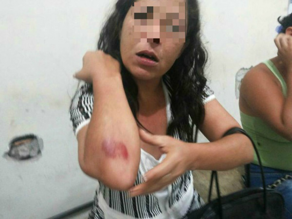 Ao voltarem de aniversário, casal briga e mulher é agredida com socos pelo marido 