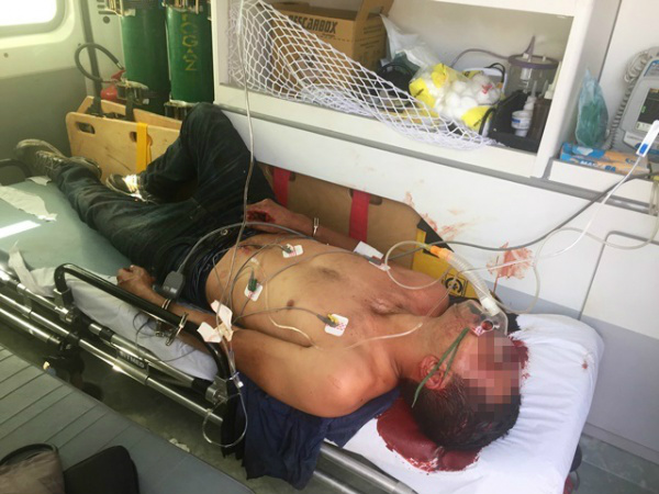 Assaltante baleado em roubo sai da UTI e passa bem Assaltante baleado em roubo sai da UTI e passa bem