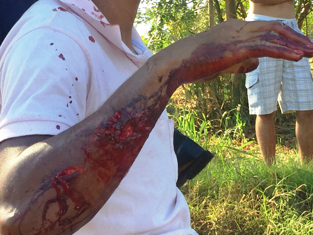Jovem em moto sofre ferimentos graves ao bater em veículo no Jupiá Jovem em moto sofre ferimentos graves ao bater em veículo no Jupiá
