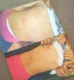 Jovem perde guarda dos filhos e acusa Casa Acolhedora de maus tratos