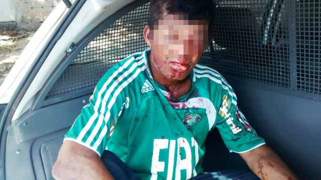 Andarilho é agredido no rosto em tentativa de assalto 