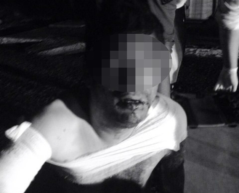 Homem leva quatro tiros na madrugada, ROTAI esclarece o crime em minutos 