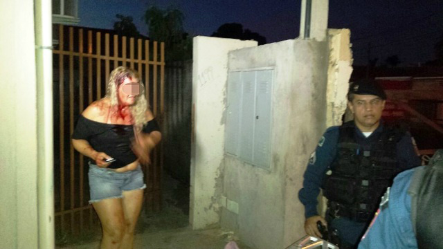 Mulher leva “capacetada” do marido após briga causada por moto 