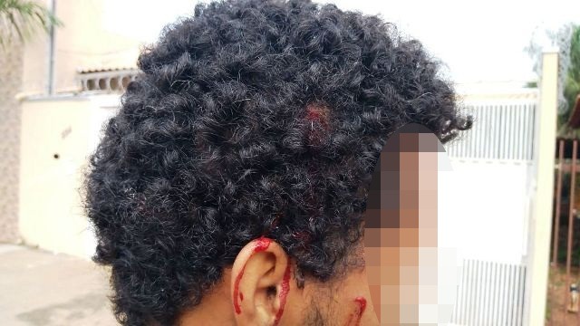 Jovem é agredido com barra de ferro e pedaço de pau 