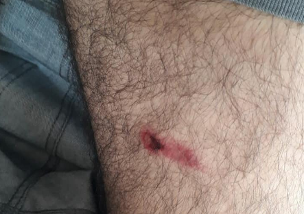 Polícia atira em homem enfurecido que resistiu à prisão