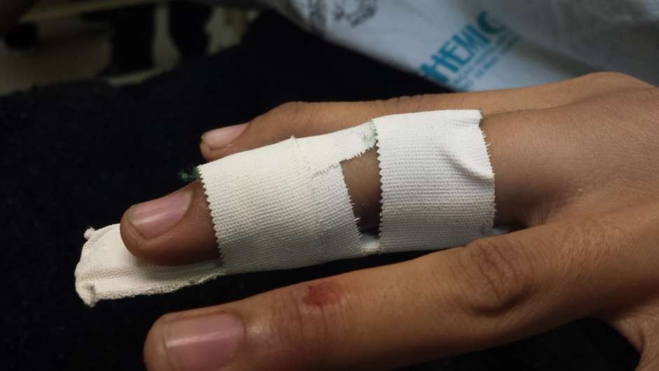 Mulher sofre suposta fratura no dedo após ser agredida pelo marido 