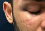 Jogo de futebol termina com agressão em Três Lagoas 