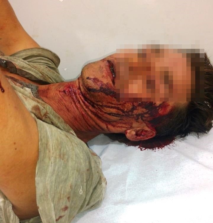 Homens se conhecem repentinamente e amizade termina com roubo e um esfaqueado