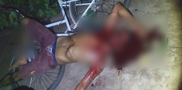 Estado de saúde de jovem esfaqueado pelo primo é considerada grave Estado de saúde de jovem esfaqueado pelo primo é considerada grave