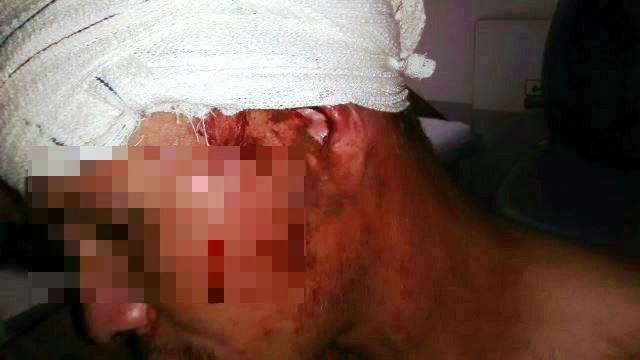 Durante briga, filho é ferido com golpe de foice pelo próprio pai Durante briga, filho é ferido com golpe de foice pelo próprio pai