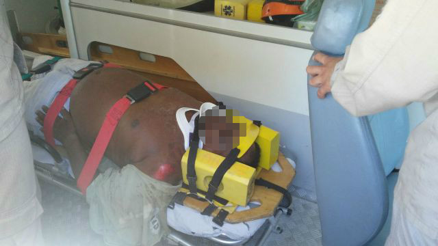 Motociclista fica ferido após colidir com traseira de caminhão no bairro Jupiá 